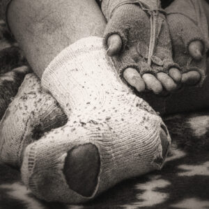 Picture of a homeless man with holes in his socks begging for money. Source Pixabay.com.